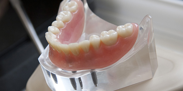 denture services